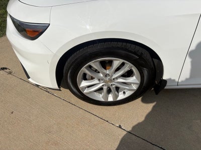 2017 Chevrolet Malibu LT 1LT